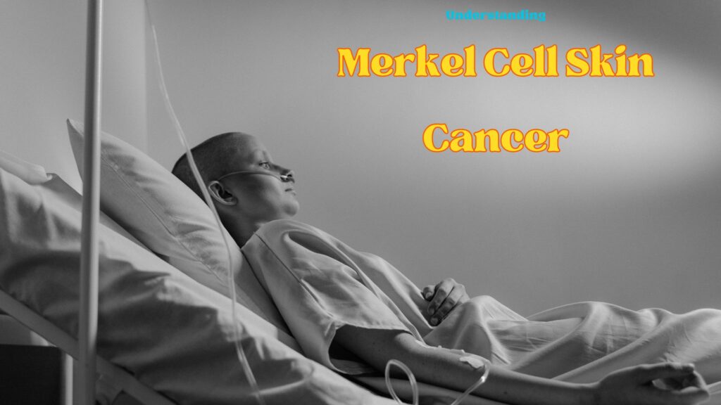 Merkel Cell Skin Cancer
